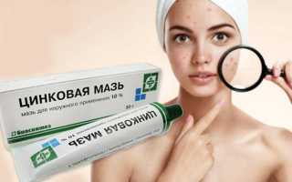 Цинковая мазь: инструкция по применению