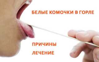 Белые комочки в горле: причины и лечение