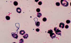 Бактерии стрептококка вириданс (Streptococcus viridans)
