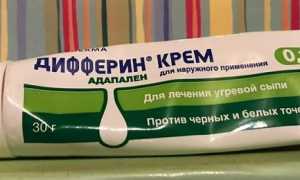 Дифферин гель от прыщей, отзывы и цена
