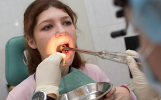 Что такое вакуумная чистка лакун миндалин, особенности процедуры