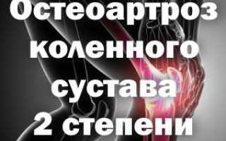 Лечение доа коленного сустава
