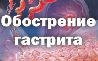 Симптомы обострения гастрита и способы терапии недуга