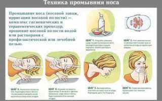 Как промывать нос физраствором взрослому и ребёнку