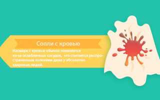 Сопли с прожилками крови причины, как лечить у взрослых и детей