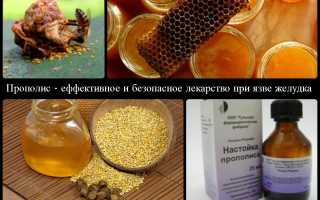 Правила и схема лечения язвы желудка прополисом