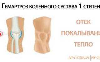 Лечение гемартроза коленного сустава