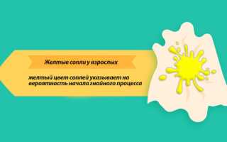 Желтые сопли у взрослого причины, лечение, народные средства
