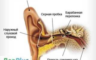 Как пробить ушную пробку в домашних условиях