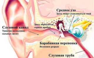 Стреляет в ухе что делать в домашних условиях