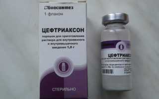 Цефтриаксон при ангине: особенности лечения