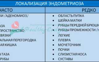 В чем схожесть и разница между эндометриозом и аденомиозом