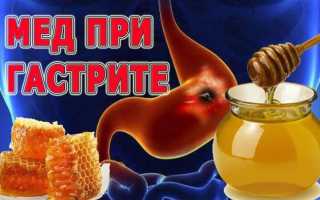 Применение и польза меда при гастрите