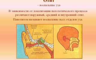 Отит: виды и методы лечения
