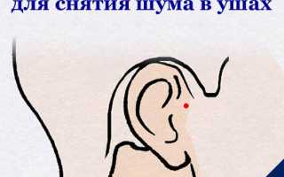 Избавляемся от шума в ушах