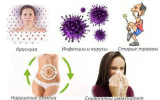 Полиартрит что это за болезнь