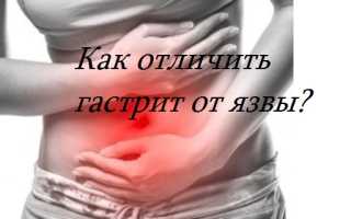 Как отличить гастрит от язвы