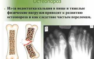 Болезнь большого пальца ноги