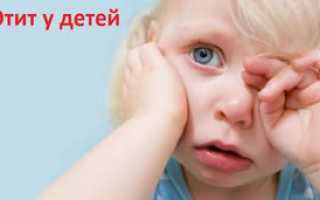 Отит у детей: лечение и профилактика — доктор Комаровский