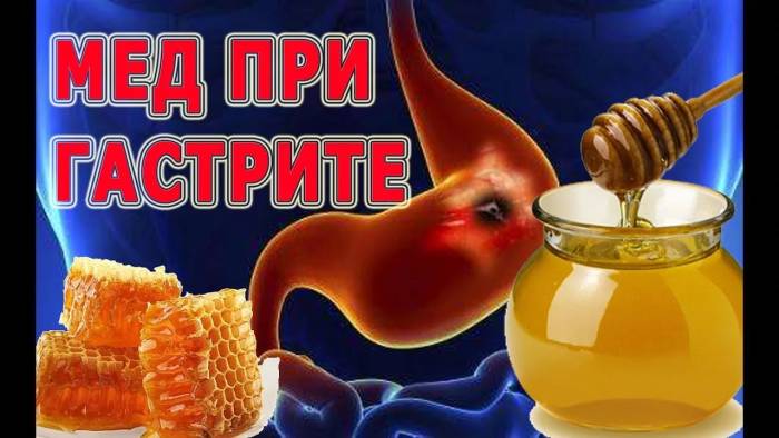 мед при гастрите