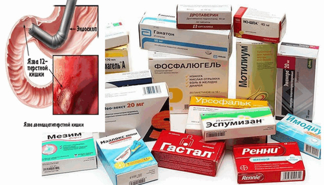 таблетки от язвы желудка
