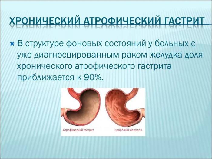 хронический атрофический антральный гастрит