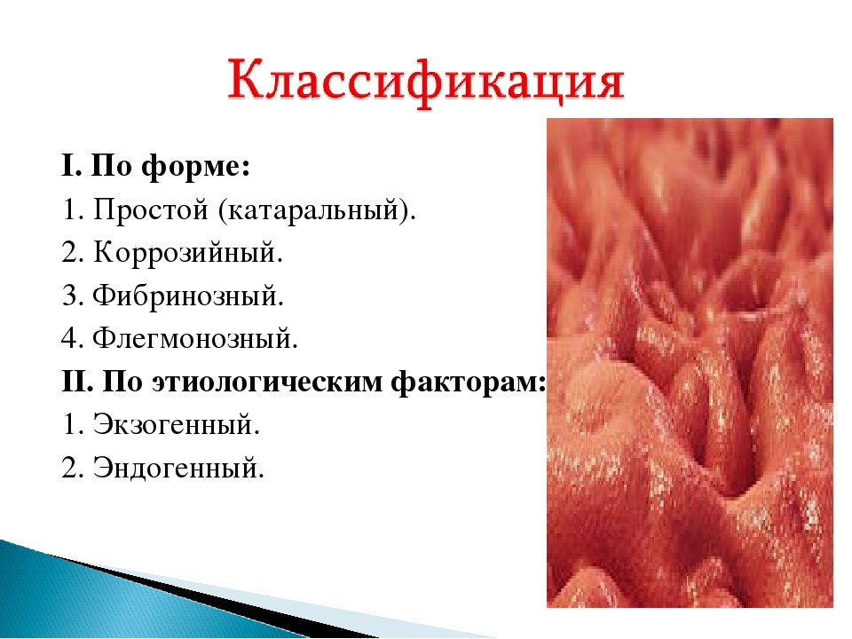 катаральный гастрит что это такое
