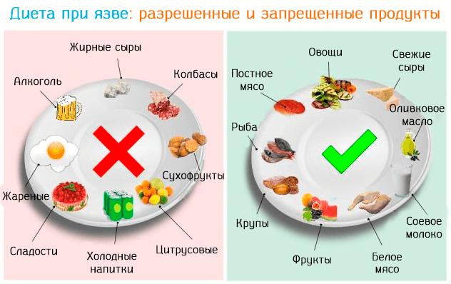 что можно есть при язве желудка