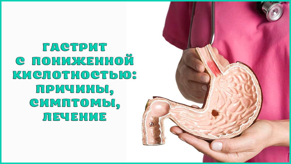 гастрит с пониженной кислотностью лечение медикаментами