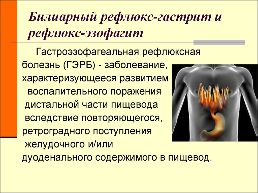 желчный рефлюкс гастрит