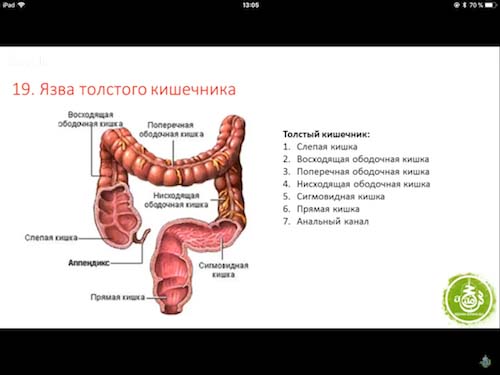 язва толстого кишечника симптомы лечение