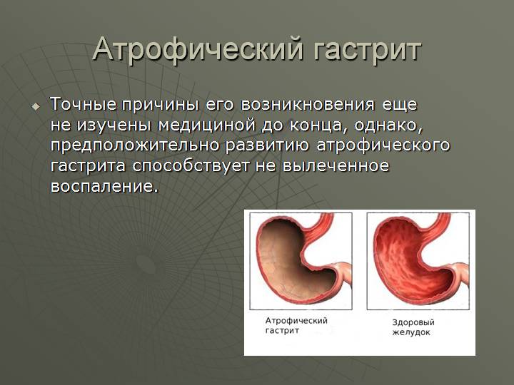 атрофический гастрит симптомы и лечение 