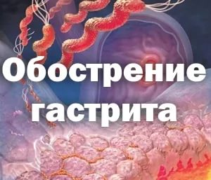 обострение гастрита симптомы 