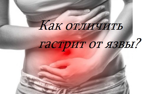как отличить гастрит от язвы