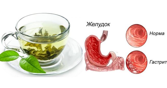 можно ли зеленый чай при гастрите