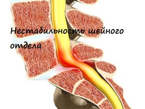 Возможная причина шума
