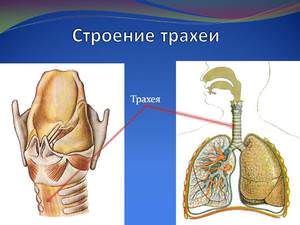 Патологии трахеи
