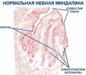 Почему вакуумное промывание действеннее обычного