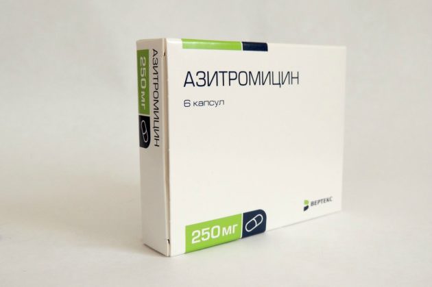 Двухсторонний гайморит лечится антибиотиками