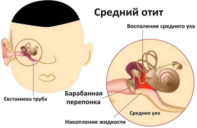 Клиника заболевания