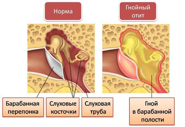 Клиника заболевания