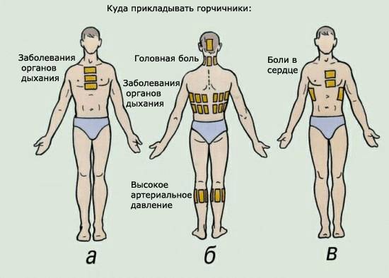 gorchichniki ot nasmorka
