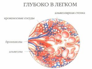 Заболевание туберкулома