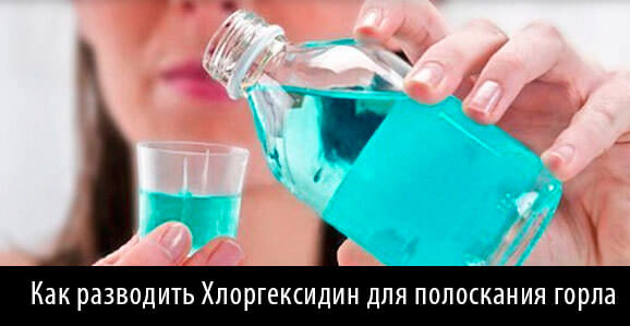 Хлоргексидин при ангине