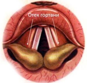 Причины развития болезни