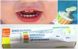 Принцип действия оксолиновой мази
