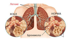 Этиологическая классификация болезни