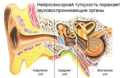 Область поражения